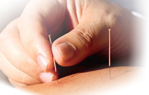 Acupuncture For Overland Park Acupuncture Clinic