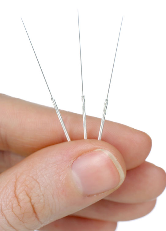 acupuncture-needles