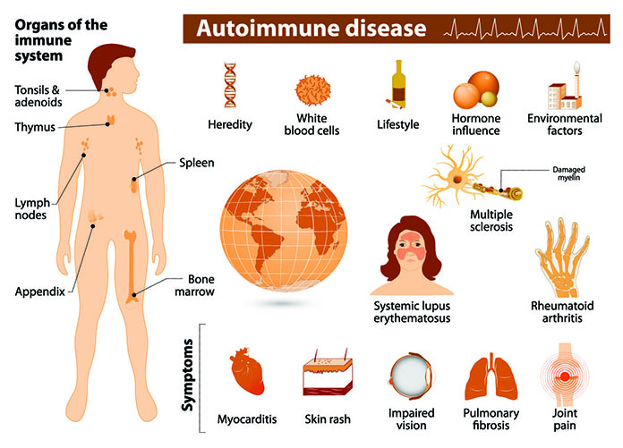 Alleviate The Symptoms Of Autoimmune Diseases With Chinese Medicine