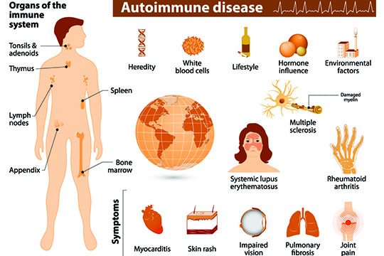 Natural Treatment Of Autoimmune Diseases In Overland Park, KS - Eastern Healing Solutions