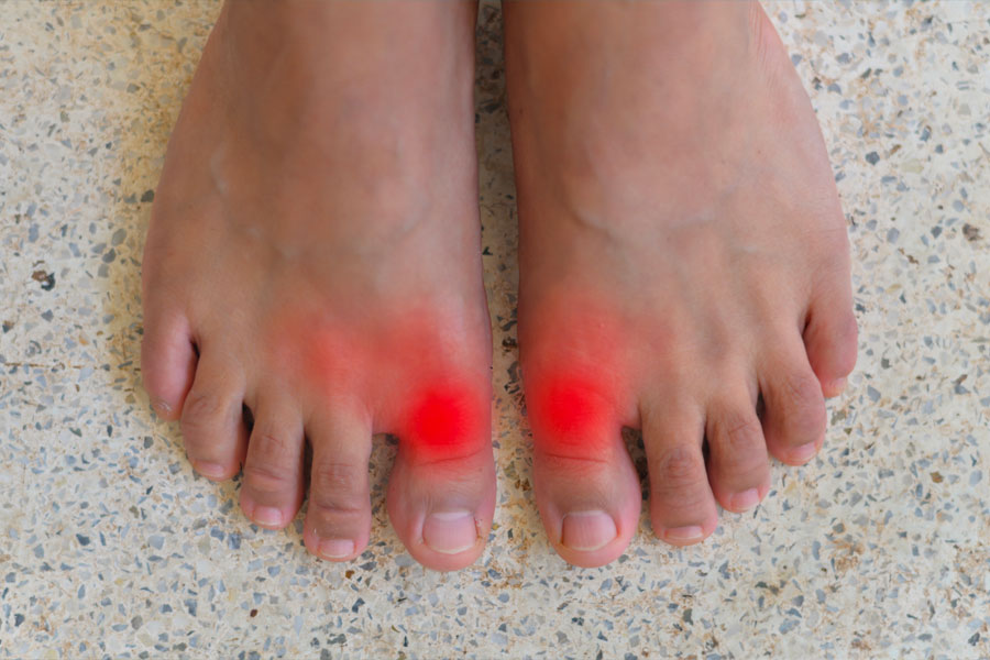 Do You Wonder What Sometimes Causes Pain in Your Big Toe? by Cindy Chamberlain