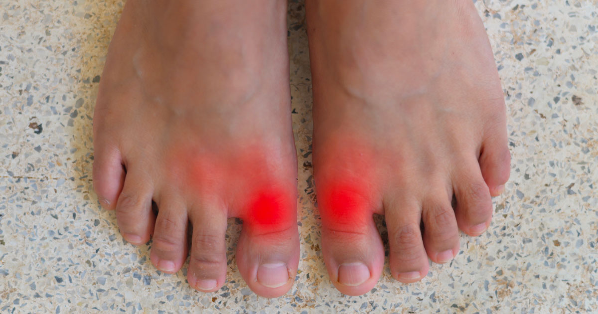 Do You Wonder What Sometimes Causes Pain in Your Big Toe?